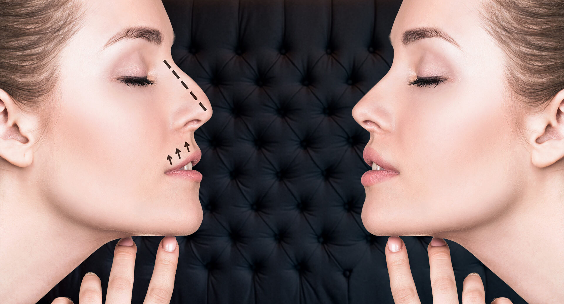 Face Before & After