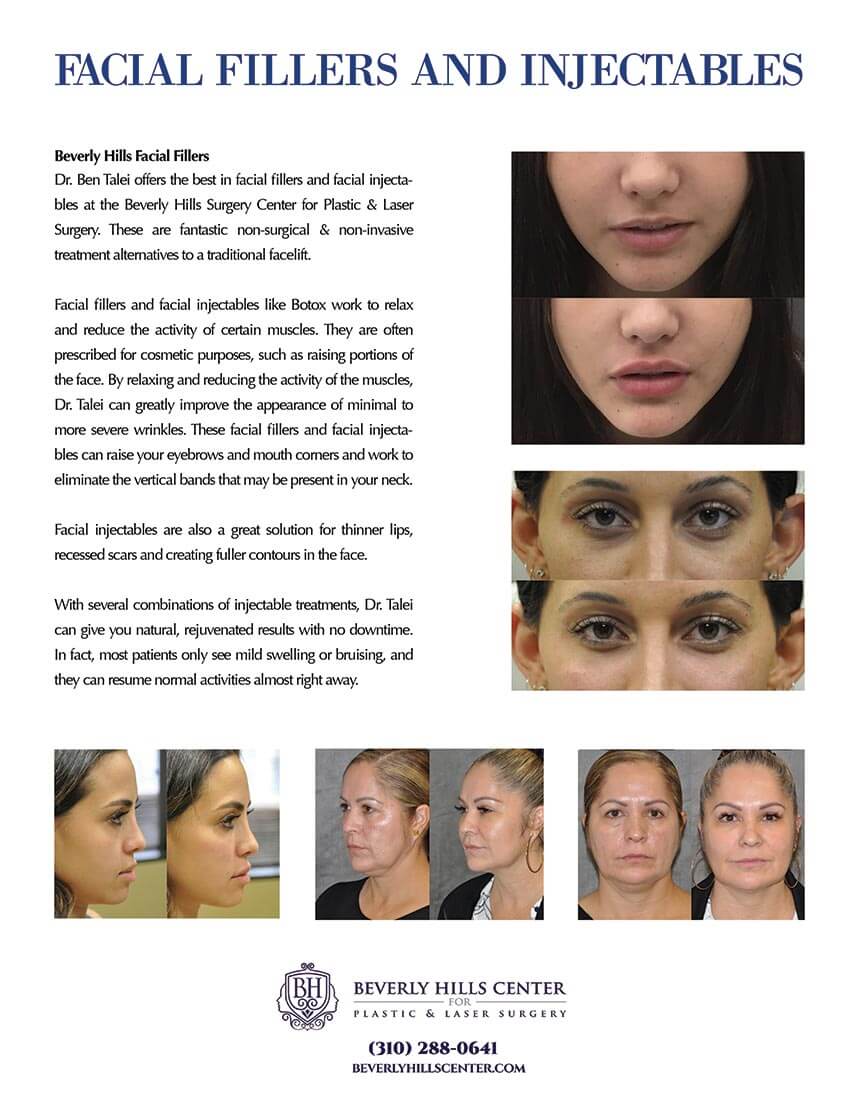 Fillers Injectables