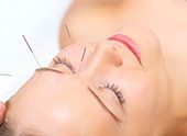 Youthful face of a woman undergoing facial acupuncture.