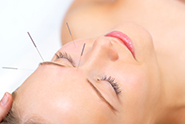 Youthful face of a woman undergoing facial acupuncture.