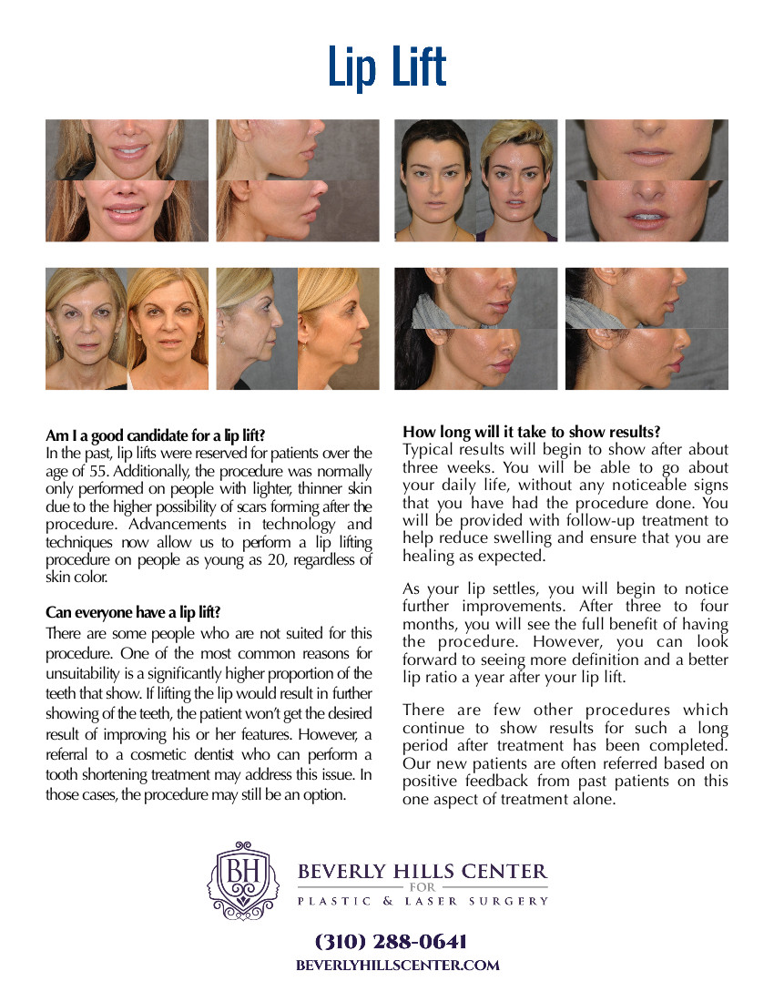 Lip Lift FAQ
