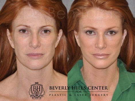 Super Model Angie Everhart - Front