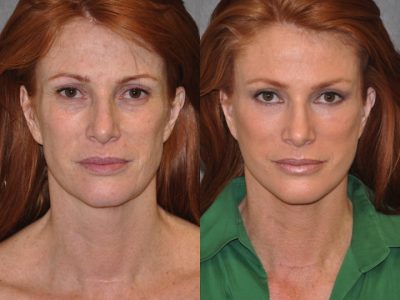 Super Model Angie Everhart – Front