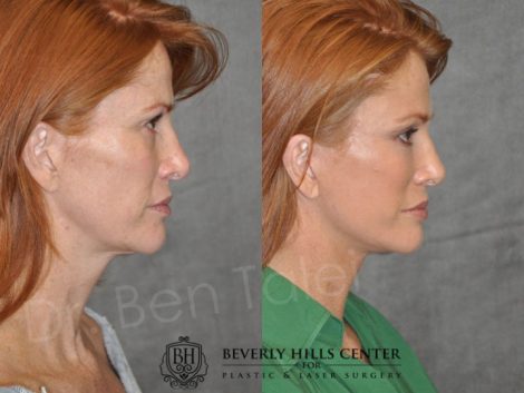 Super Model Angie Everhart - Right Side