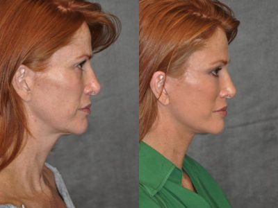 Super Model Angie Everhart – Right Side