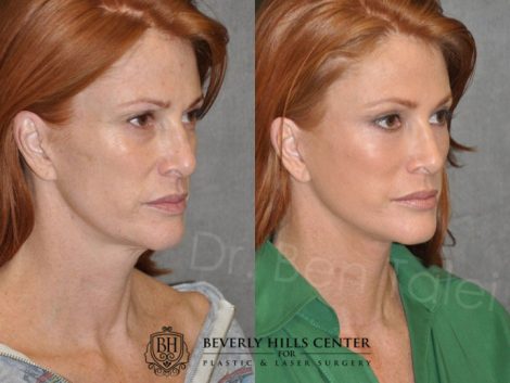 Super Model Angie Everhart - Right Side