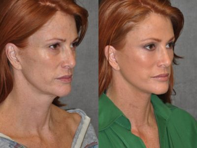Super Model Angie Everhart – Right Side