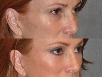 Super Model Angie Everhart - Right Side