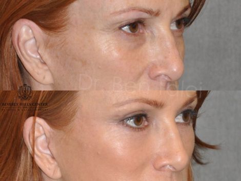 Super Model Angie Everhart - Right Side