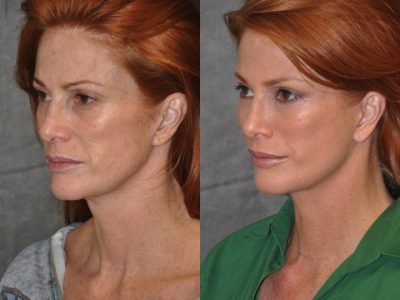 Super Model Angie Everhart - Left Side