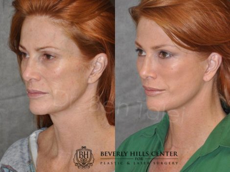 Super Model Angie Everhart - Left Side