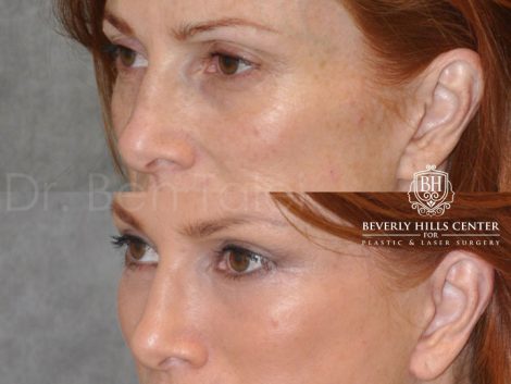 Super Model Angie Everhart - Left Side