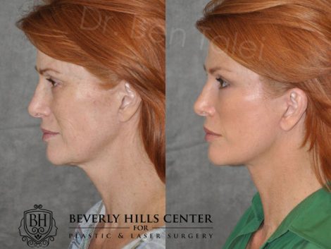 Super Model Angie Everhart - Left Side