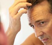 Hair Transplant Beverly Hills CA