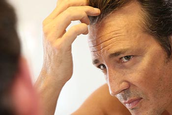 Hair Transplant Beverly Hills CA