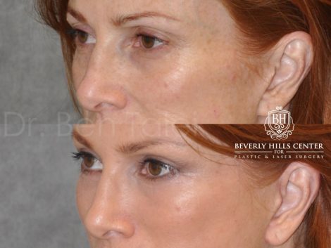 Super Model Angie Everhart - Left Side