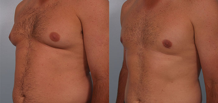 Two side-by-side images of a male torso before and after transformation. The first shows more body fat, the second shows a leaner physique.